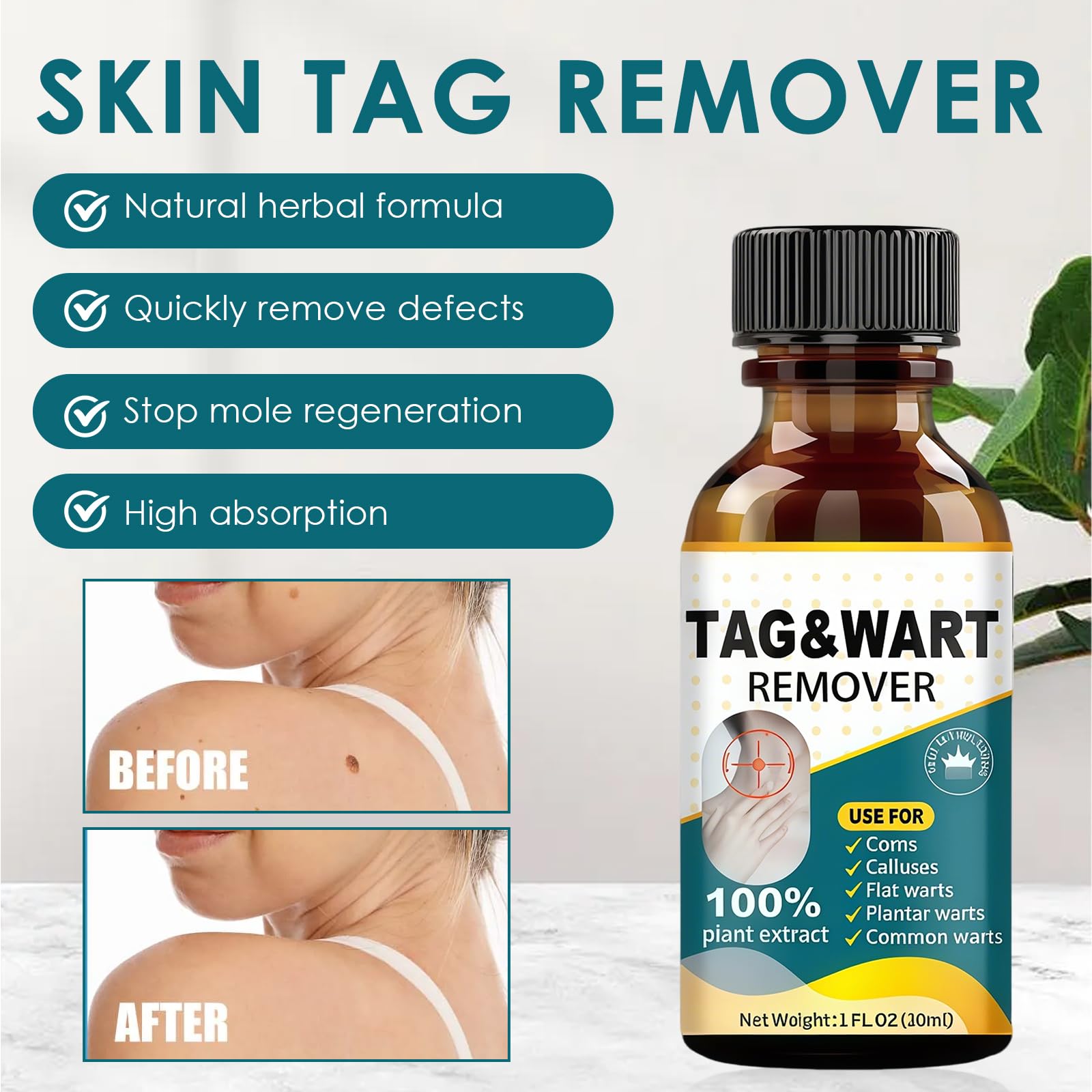 30ml SolucióN Anti-Verrugas, AplicacióN Precisa En Puntos EspecíFicos, Restaurar La Suavidad De La Piel, Manos Y Pies