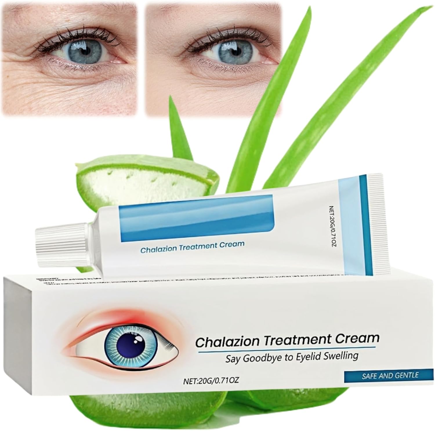 Chalazion Treatment Cream, Blepharitis & Stye Eye Treatment, Soothing ...