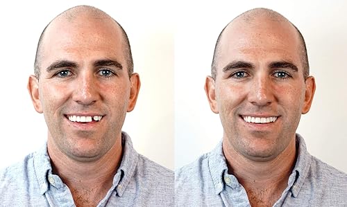 Miniatura 2 de Instant Smile Kit de dientes temporales de triple sombra: reemplaza un diente perdido en solo 5 minutos