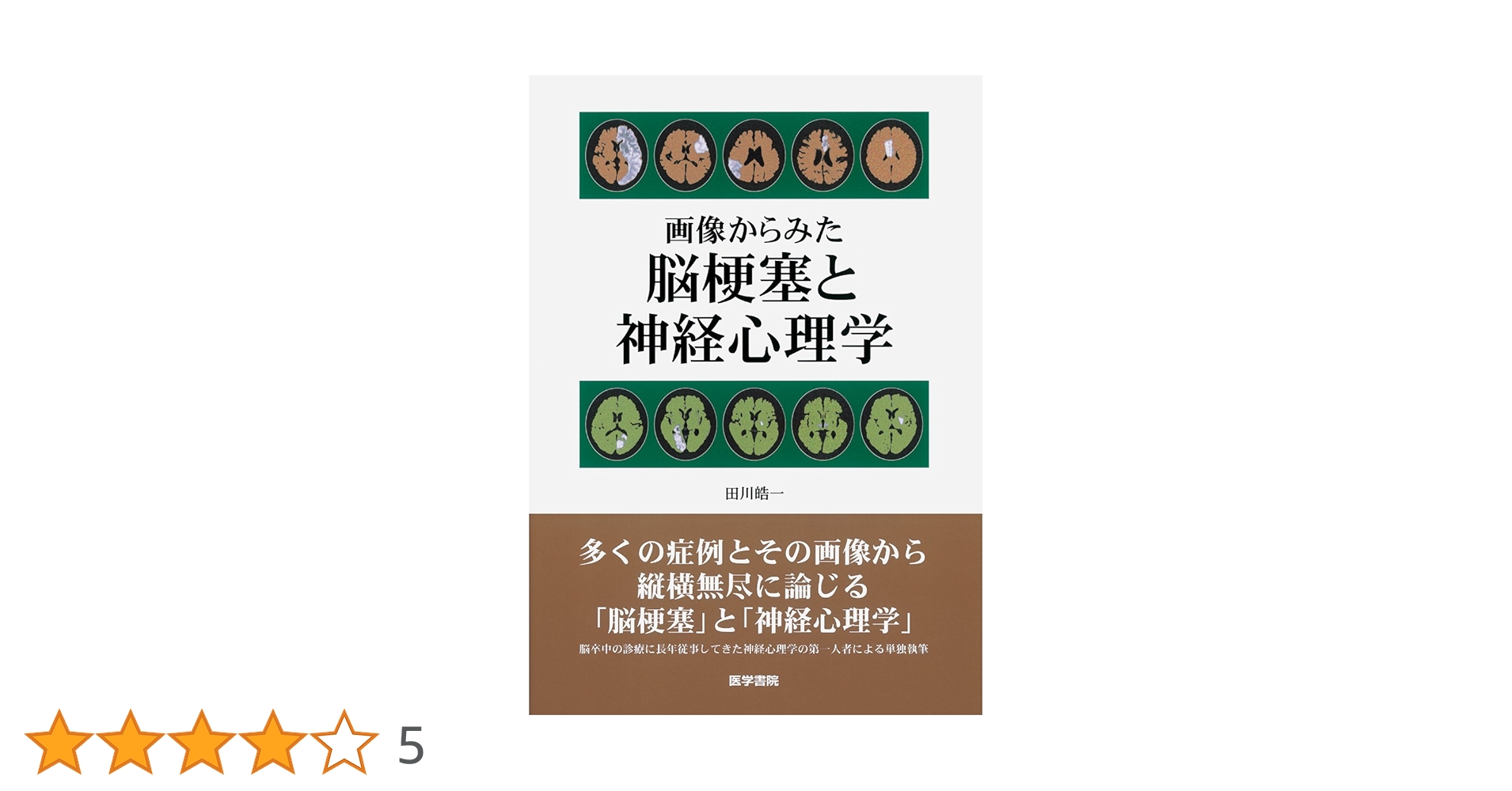画像からみた脳梗塞と神経心理学 画像からみた 脳梗塞と神経心理学 | 田川 皓一 |本 | 通販 | Amazon