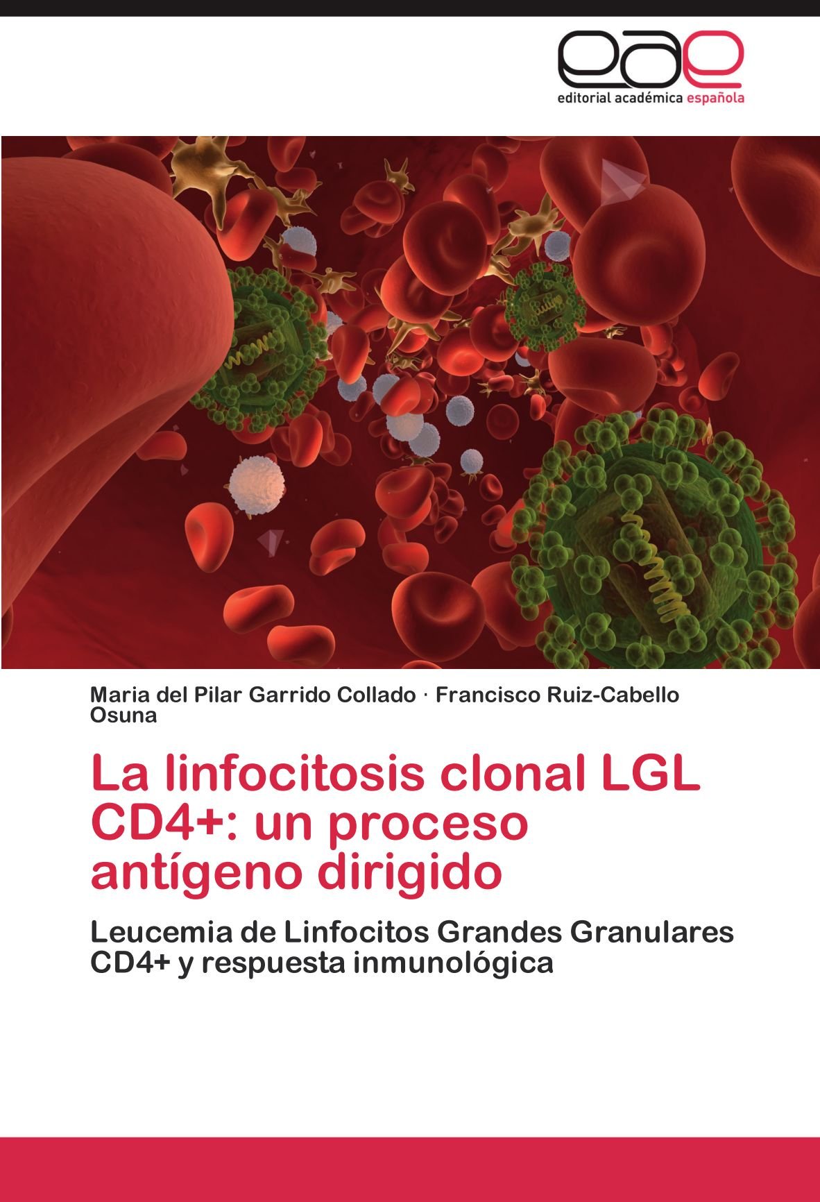 La linfocitosis clonal LGL CD4+: un proceso antígeno dirigido