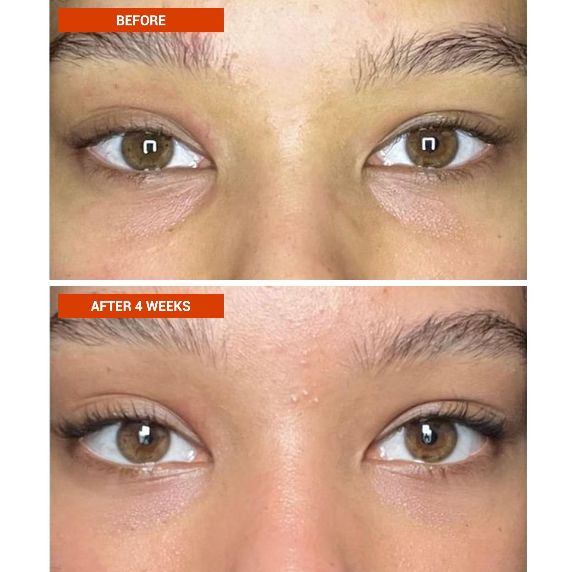 BeautyStat Universal C Eye Perfector Cream - Hydratisiert, strafft und hebt mit Vitamin C, Hyaluronsäure & Grüntee-Extrakt, Duftfrei gegen Augenringe und Schwellungen, Sicher für empfindliche Haut
