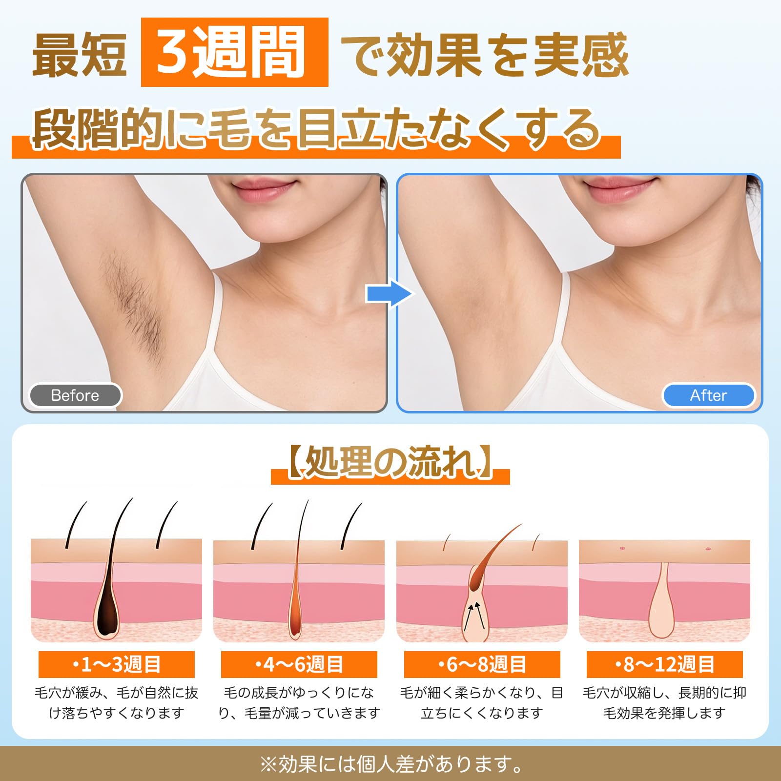Amazon | 脱毛器 VIO対応【2026新登場・冷感ケア搭載】IPL光美容器