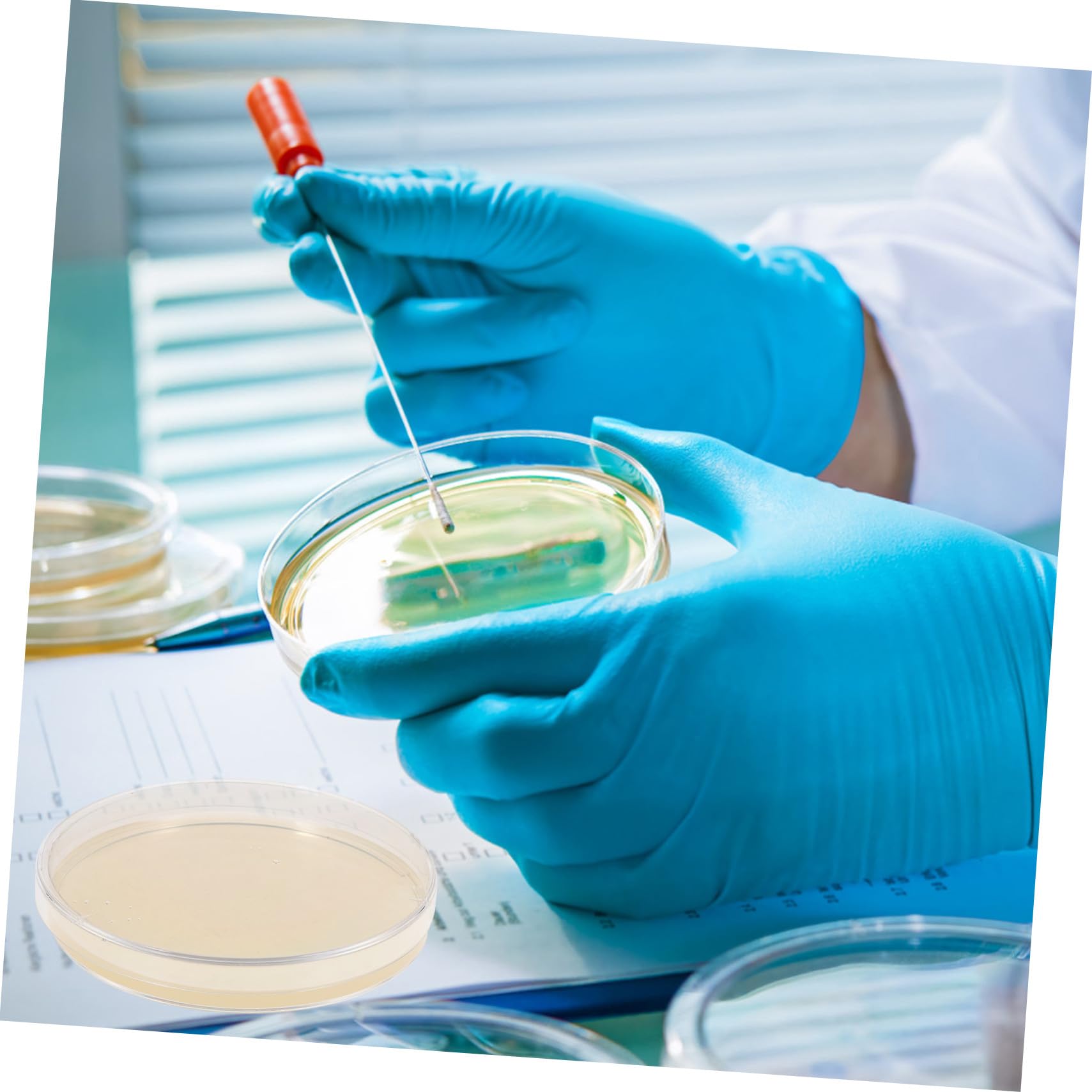 Placas De Agar Nutritivo 9 Cm Pre-vertido, Paquete De 10 Unidades, Placas De Petri Para Cultivo Microbiológico, Suministros Para Experimentos Científicos y Proyectos Escolares