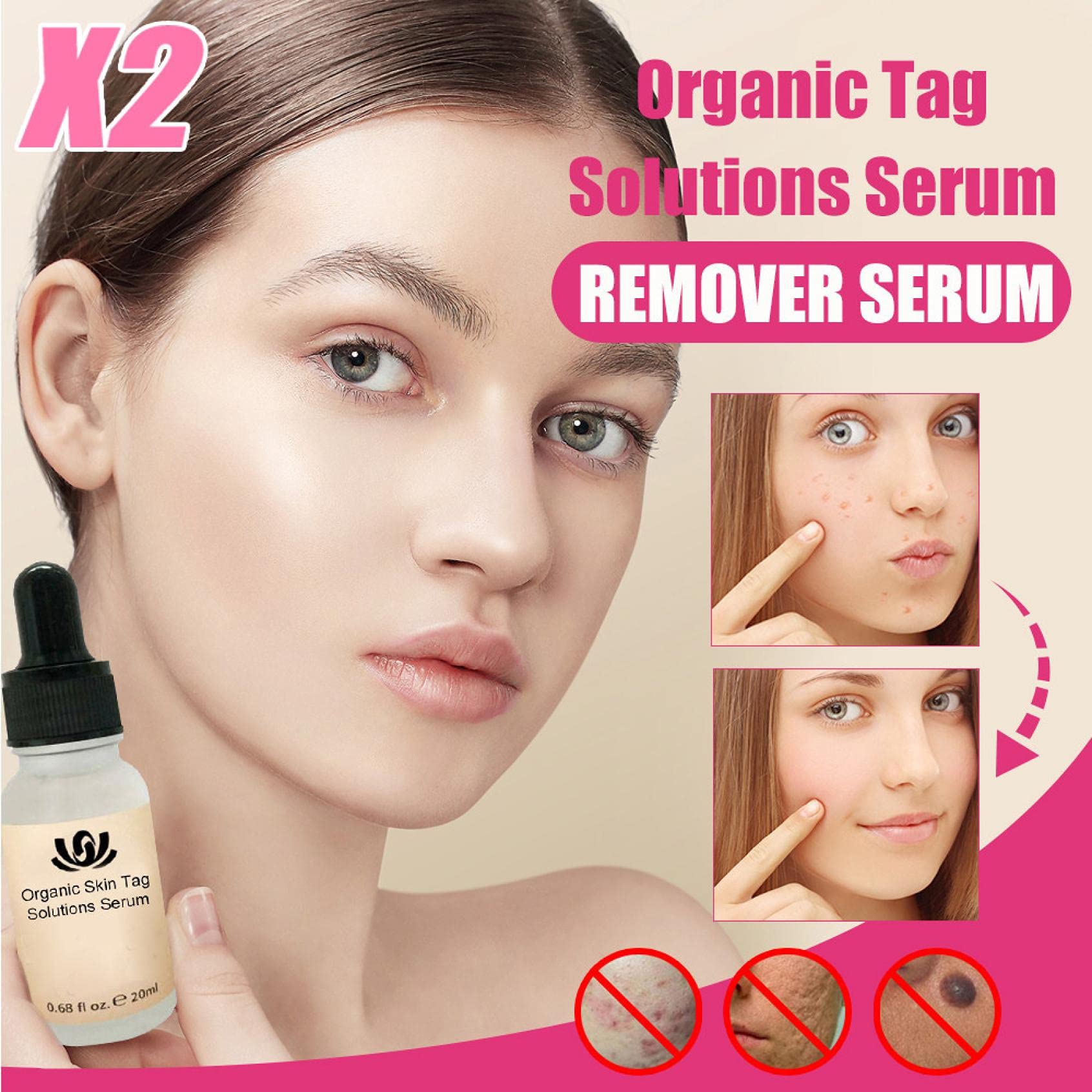 Buy 2PCS Niacinamide Organic Skin Tag Solutions Serum Herbal Treatment
