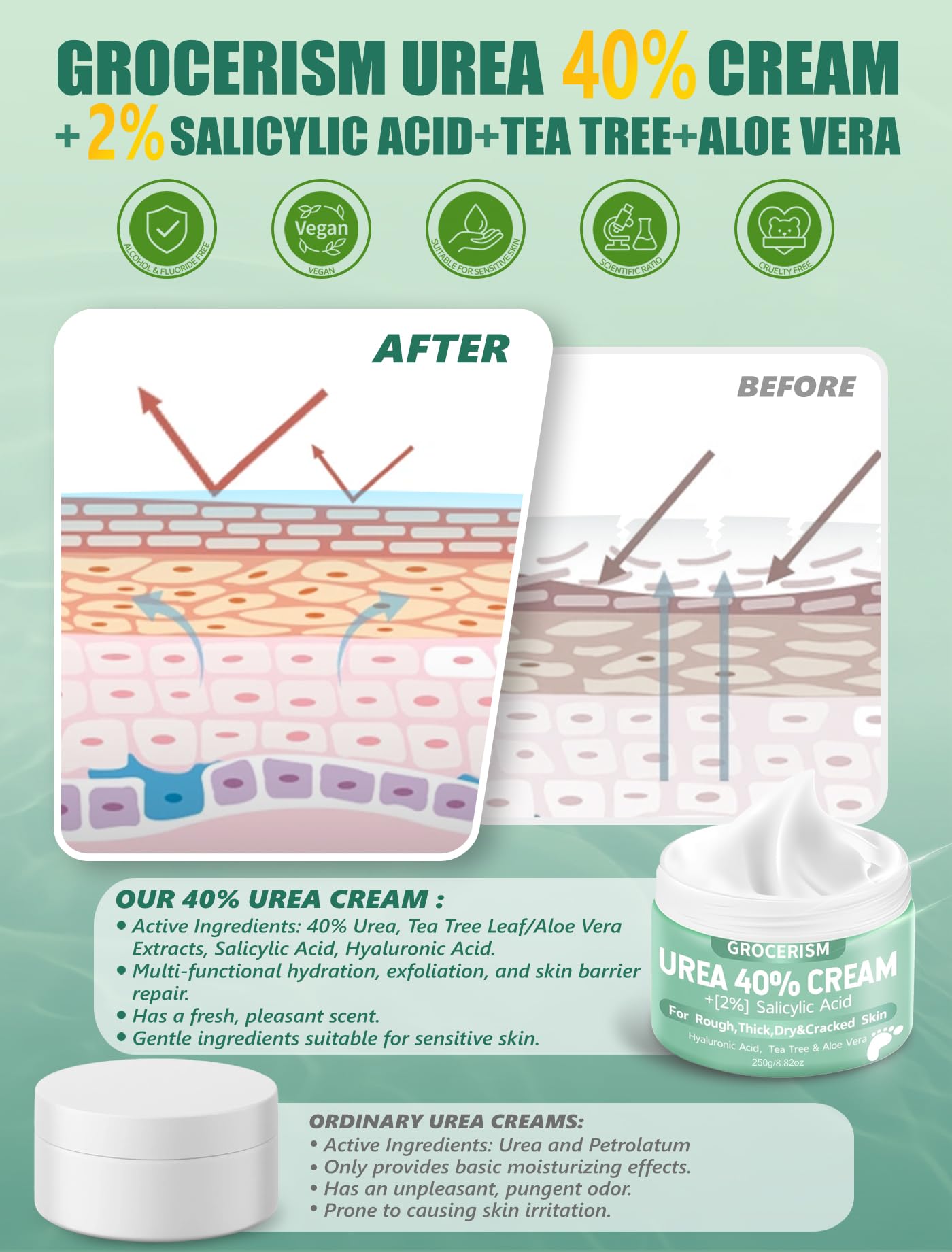 Crema Piedi Urea 40% 150g || Crema Piedi e Mani Con Acido Ialuronico, Tea Tree, Aloe Vera – Idratazione Profonda, Calli-40% 150g