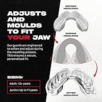 Vista 2 de SAFEJAWZ Protector bucal, ajustado para adultos y jóvenes con funda, boquilla extraíble de fácil ajuste para fútbol, boxeo, lacrosse, artes