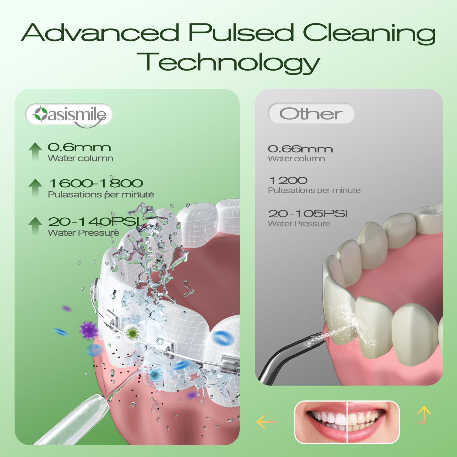 OasiSmile Irrigador bucal C2 para dientes, irrigador oral inalámbrico de 350 ml para aparatos ortopédicos y encías sensibles, presión ajustable de bricolaje, 4 modos, 5 puntas de chorro, púa dental
