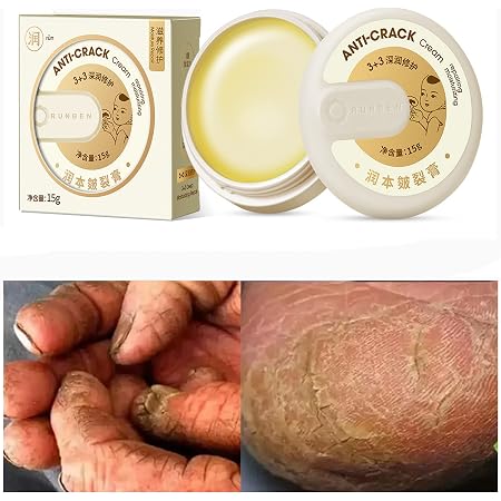Hand and Foot Repair Cream Cracked Skin 
