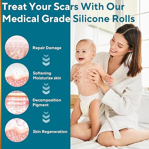 Miniatura 3 de Hojas de silicona para cicatrices, cinta de silicona para cicatrices, tiras de silicona reutilizables para tratamiento de eliminación de cicatrices,