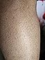 Ulike Laser Hair Removal Device Air 10 Ipl and Men, Ice cool and Permanent hair Reduction for Nearly Painless, Dual Lights, Skin Sensor & USHR Mode Hair Removal in 10mins from Home