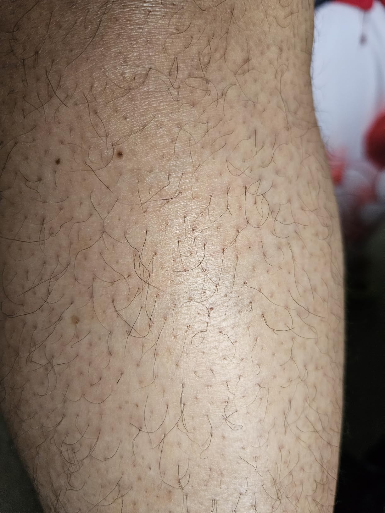 Ulike Laser Hair Removal Device Air 10 Ipl and Men, Ice cool and Permanent hair Reduction for Nearly Painless, Dual Lights, Skin Sensor & USHR Mode Hair Removal in 10mins from Home