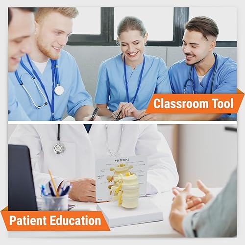 Miniatura 3 de Lumbar vertebrae 3-pc L2, L3& L4aula anatómicos modelo de Educación CEM