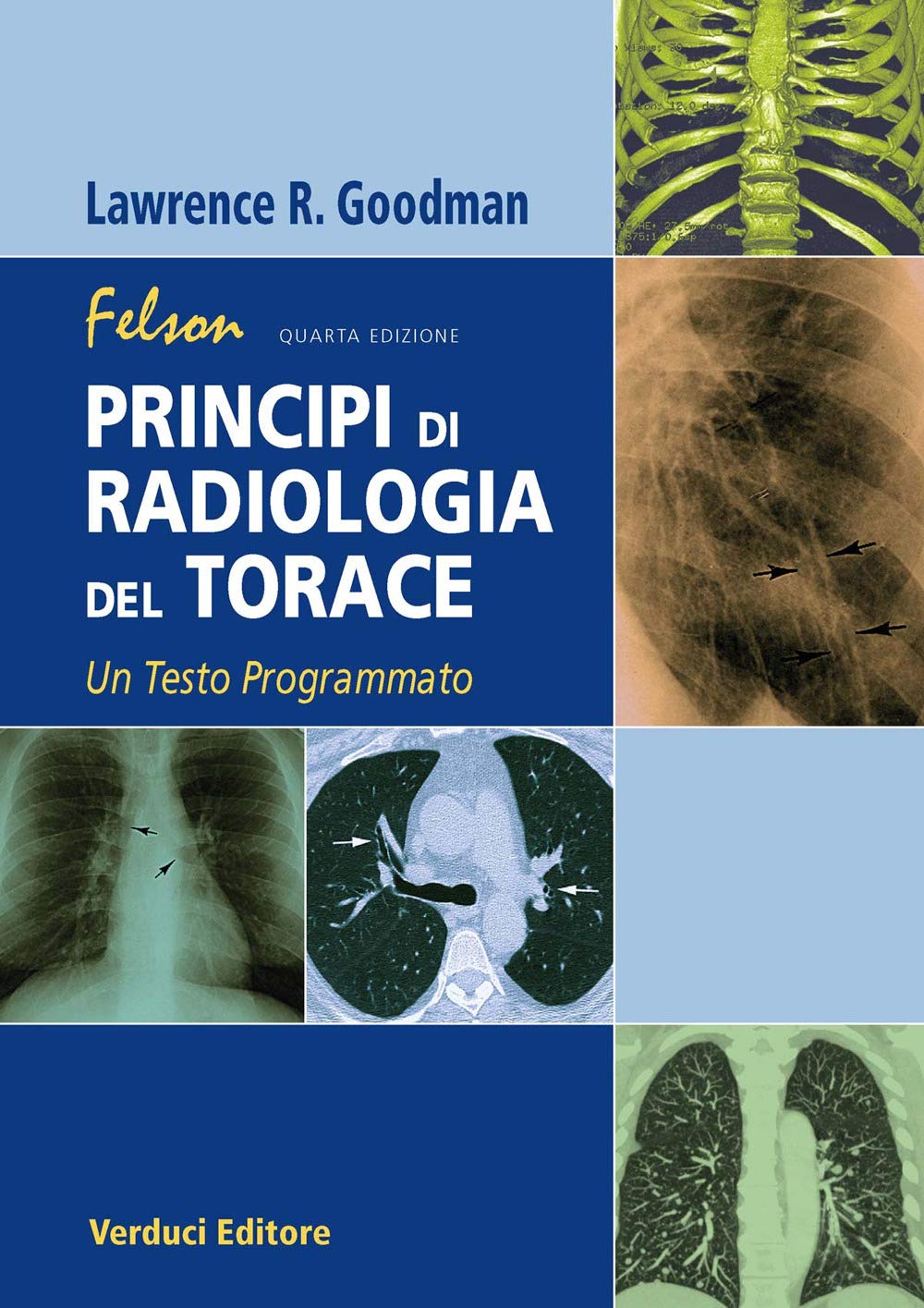 Felson. Principi Di Radiologia Del Torace. Un Testo Programmato - 4
