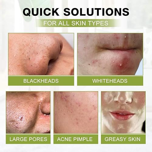 Miniatura 5 de SHVYOG Máscara Facial de Puntos Negros, Máscara Removedora de Puntos Negros 3-en-1 con Cepillo y Suero de Aceite de Árbol de Té, Máscara de Carbón