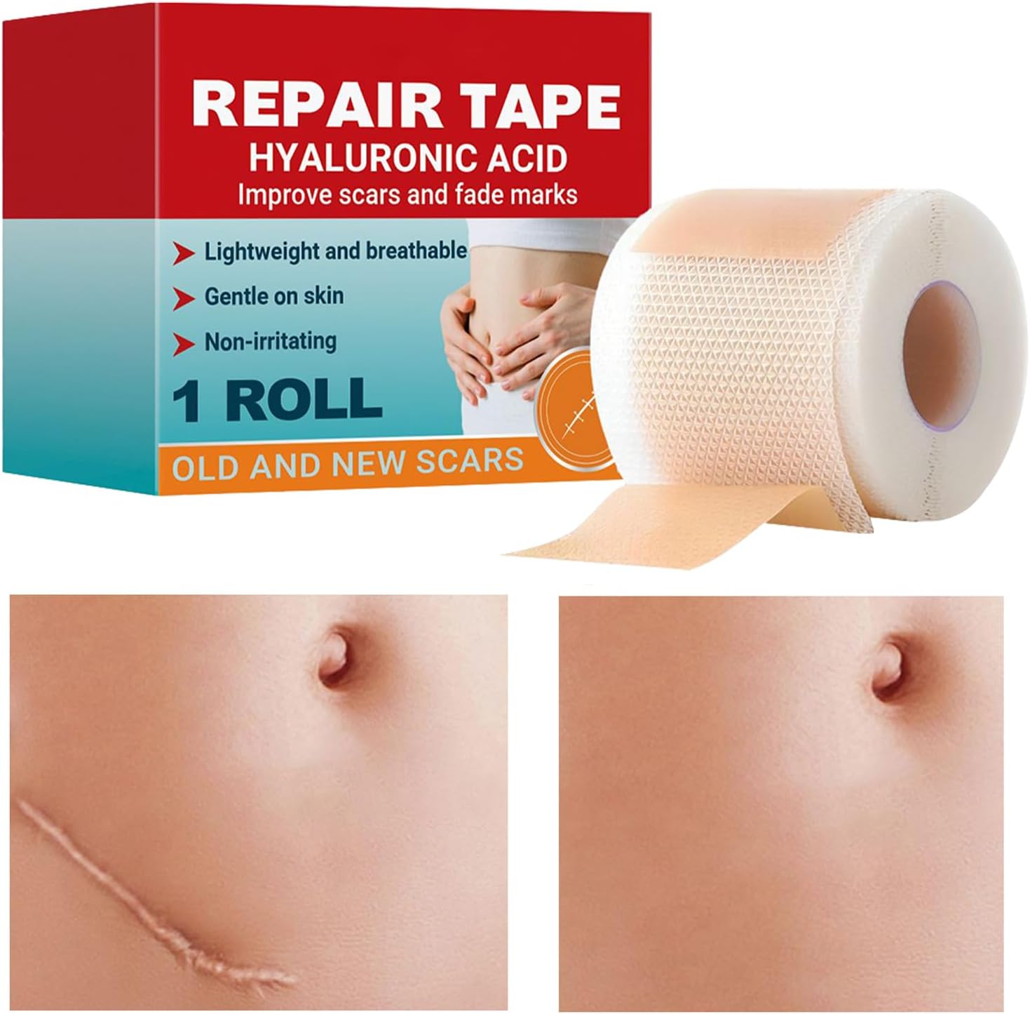 Silicone Sheets for Scars | Wound Stickers - Breathable Scar Patch,for Men Elderly Stretch Marks Face Body Breast Reduction Burn Pregnant