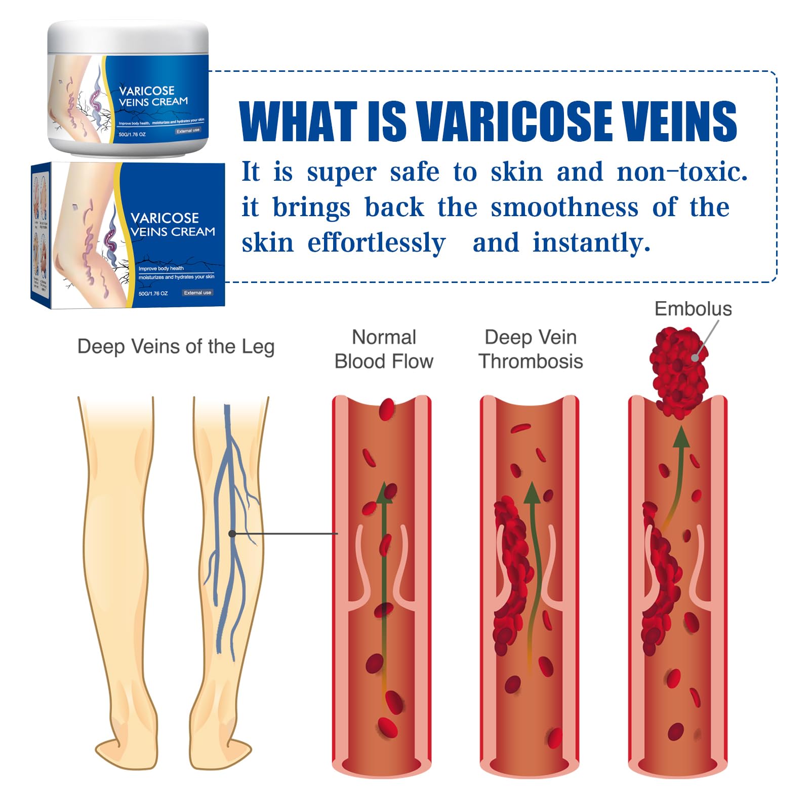 Varicose Veins Cream, Beinpflegebalsam – Creme Gegen Besenreiser, Krampfadern und Besenreiser Entfernen, Natürliche Beinpflege, Verbessert Durchblutung, Pflegt und Beruhigt Müde Beine