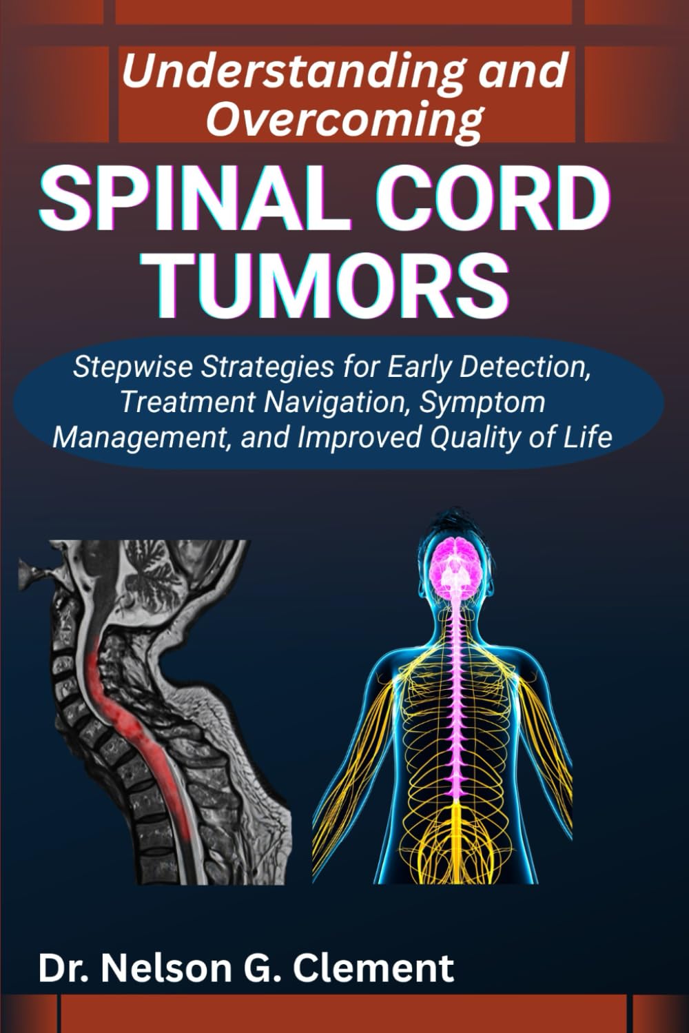 UNDERSTANDING AND OVERCOMING SPINAL CORD TUMORS: Stepwise Strategies for Early Detection, Treatment Navigation, Symptom Management, and Improved Quality of Life