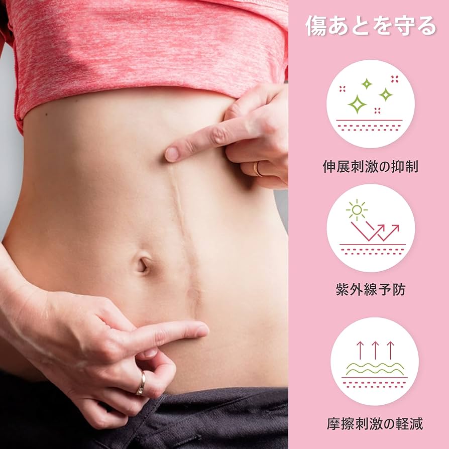 クリニセルS 傷あとケア（火傷 ケガ 手術あと 帝王切開あと） クリニセル【龍野マルゼン薬店】