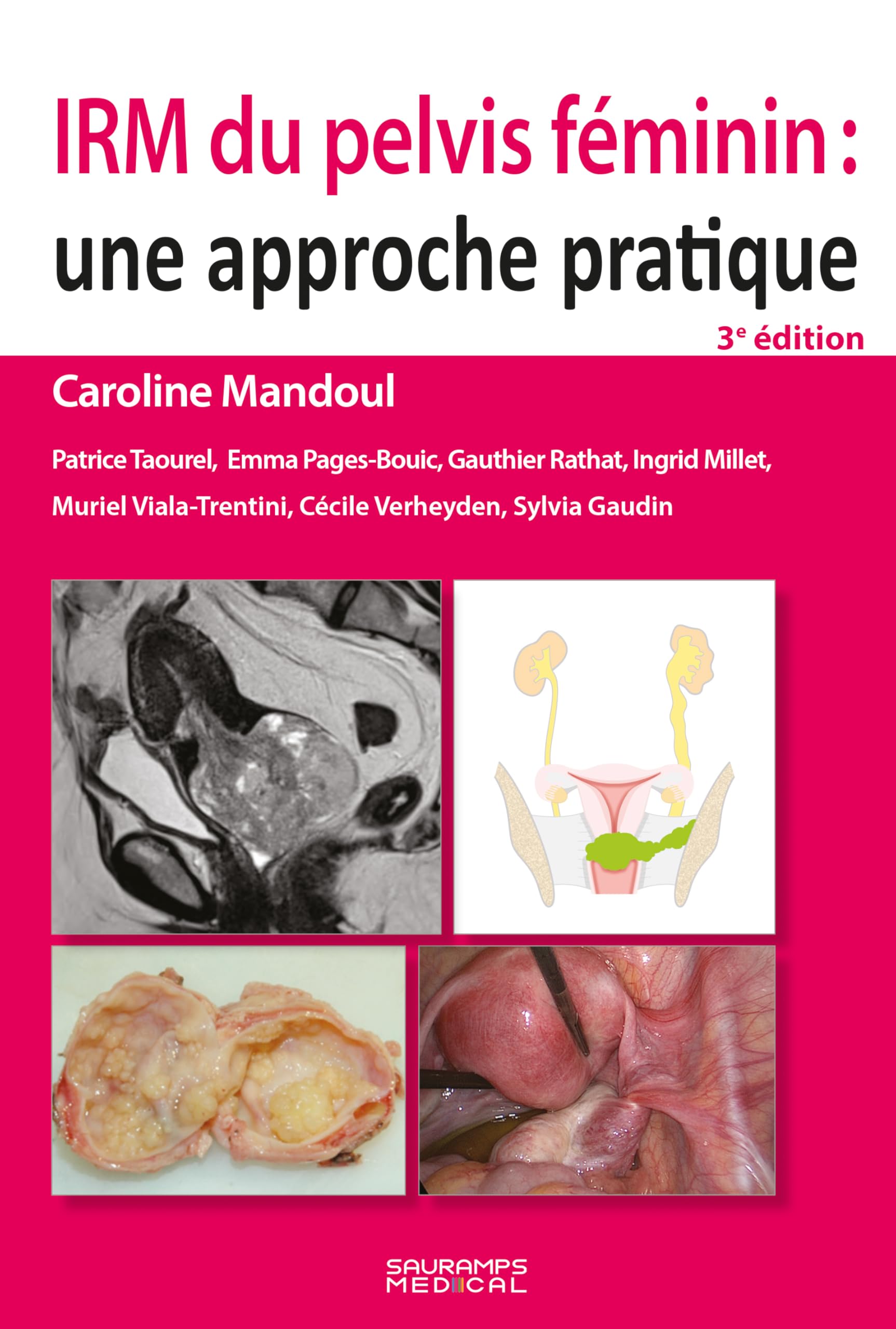 IRM du pelvis féminin : une approche pratique 3e ed