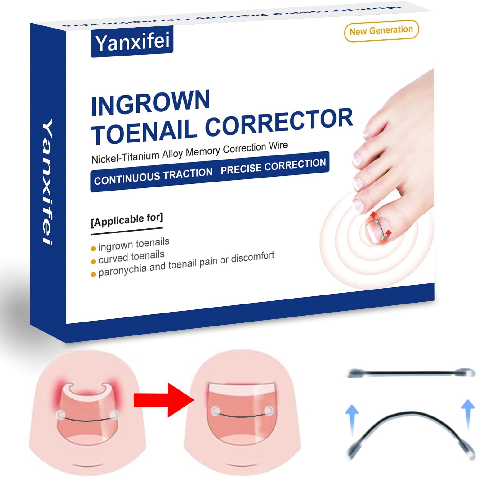 Nitinol Ingrown Toenail Corrector,At Home Treatment,Curved Straightener,Ingrown Toe Nail Relief，Ingrown Removal Kit (11/16 In,13/16 In)
