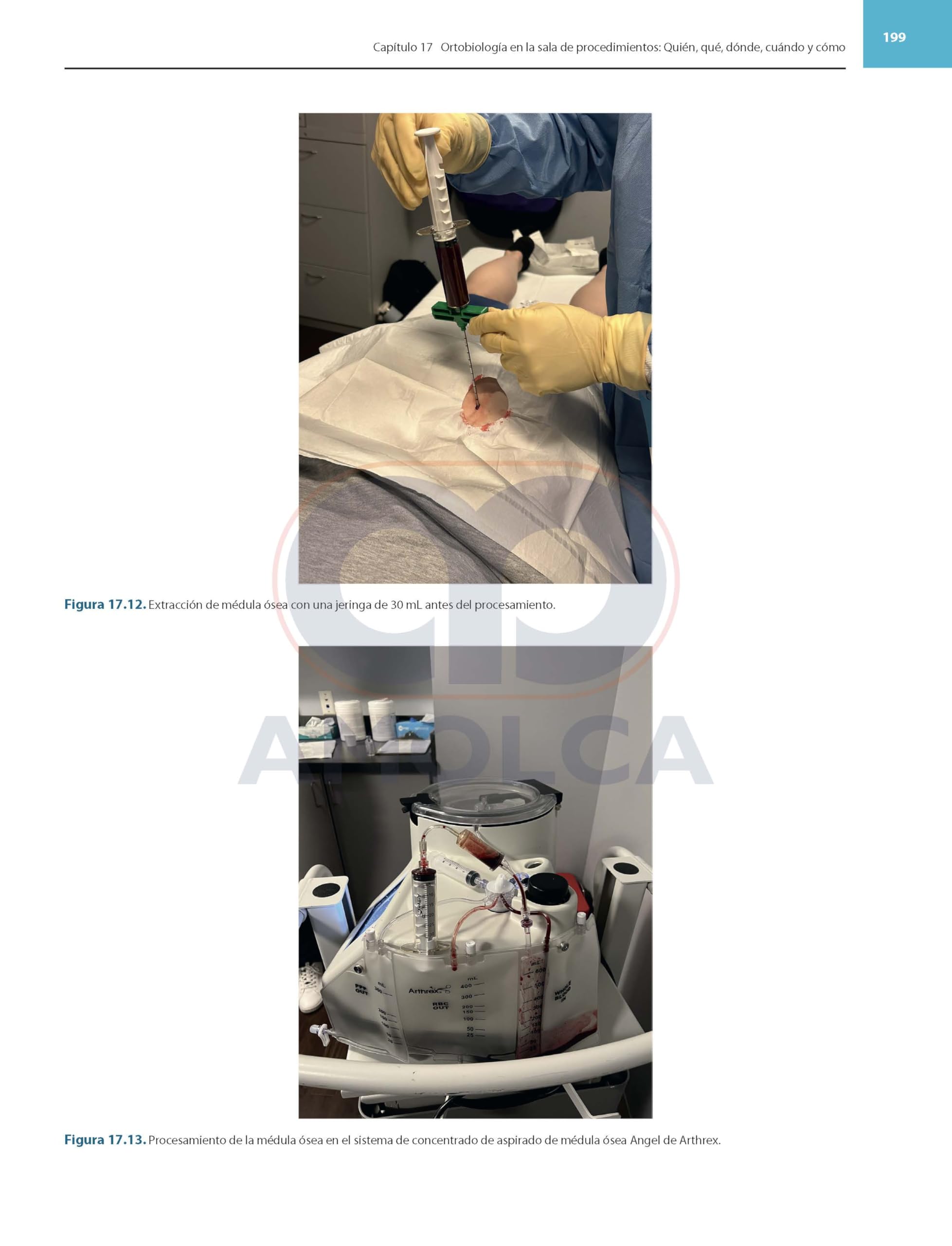 Ortobiologicos avances y aplicaciones clinicas en medicina