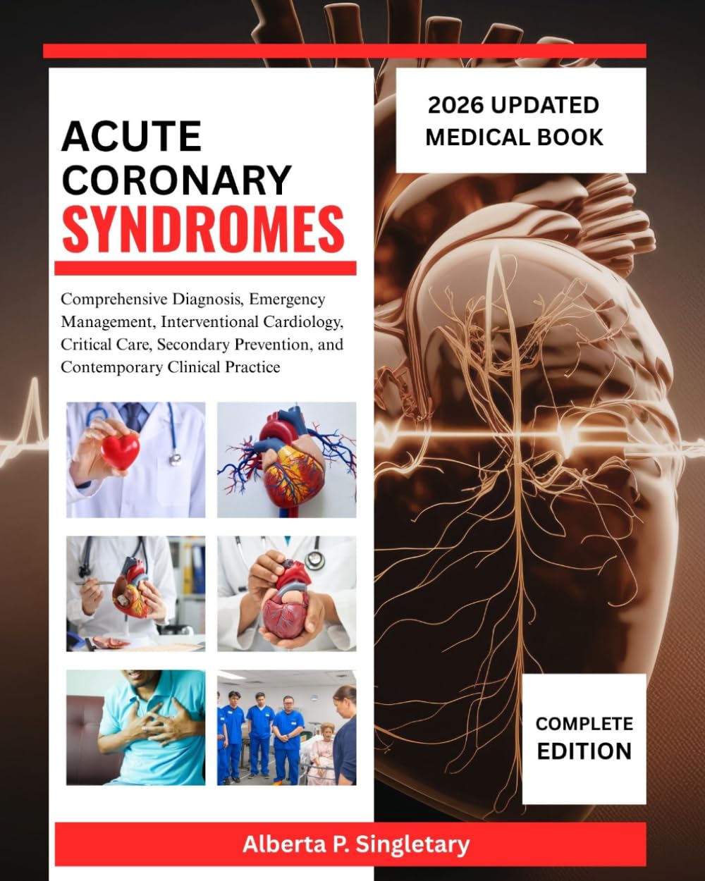 Acute Coronary Syndromes: Comprehensive Diagnosis, Emergency Management, Interventional Cardiology, Critical Care, Secondary Prevention, and Contemporary Clinical Practice