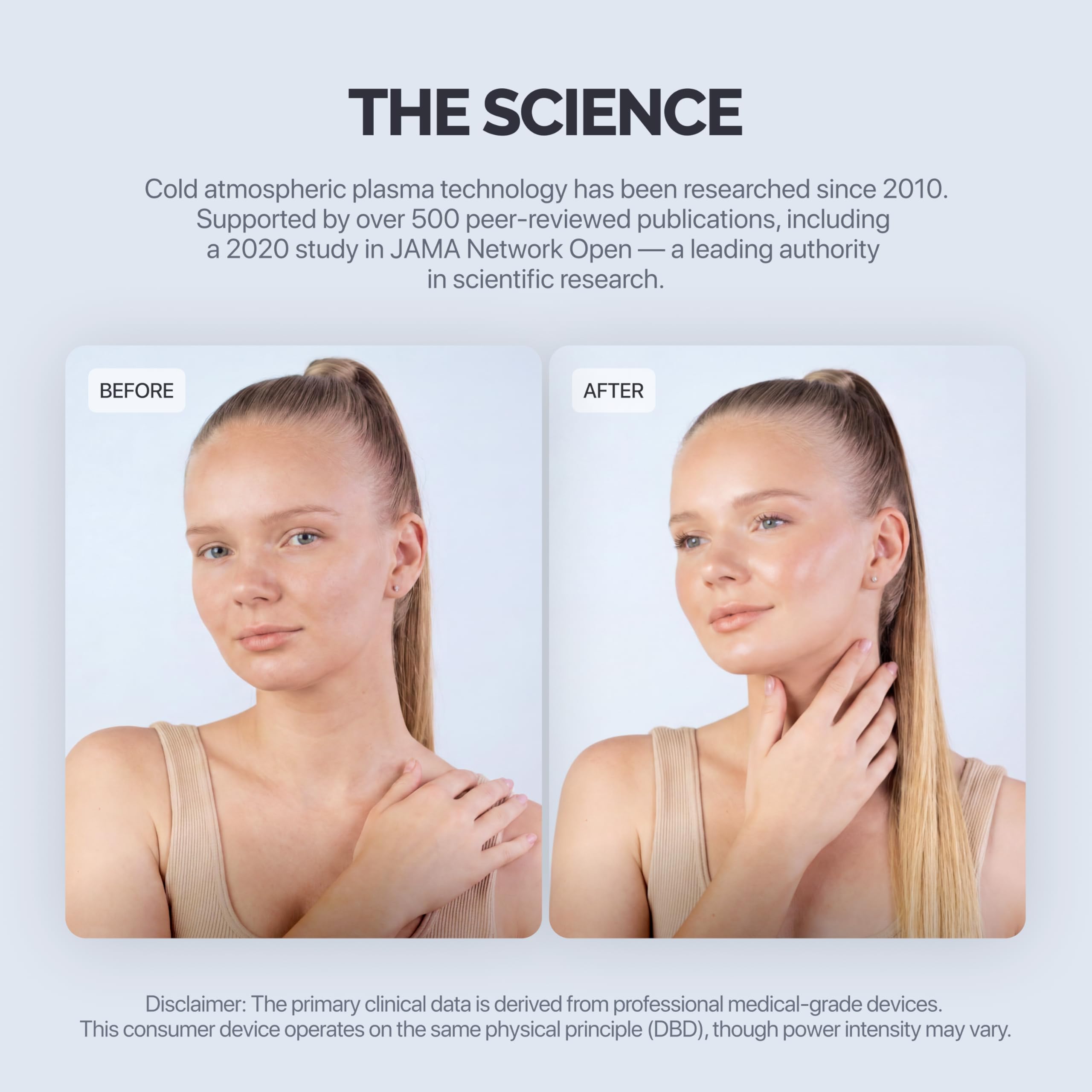 GESS Plasma Energy - Massaggiatore al plasma a freddo con piastra in ceramica, per la cura della pelle del viso, ad alta frequenza per acne, per pelli sensibili