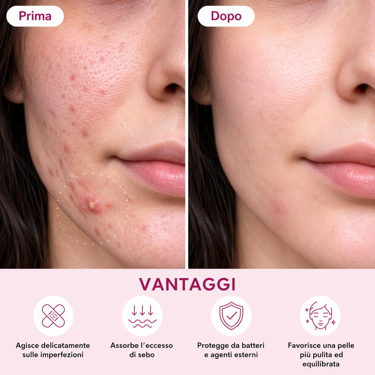 Enida – 96 patch anti-brufoli invisibili | 3 misure | azione mirata in una notte | patch idrocolloidi per acne | Cura viso discreta per adolescenti e adulti, senza profumo + eBook di bellezza in