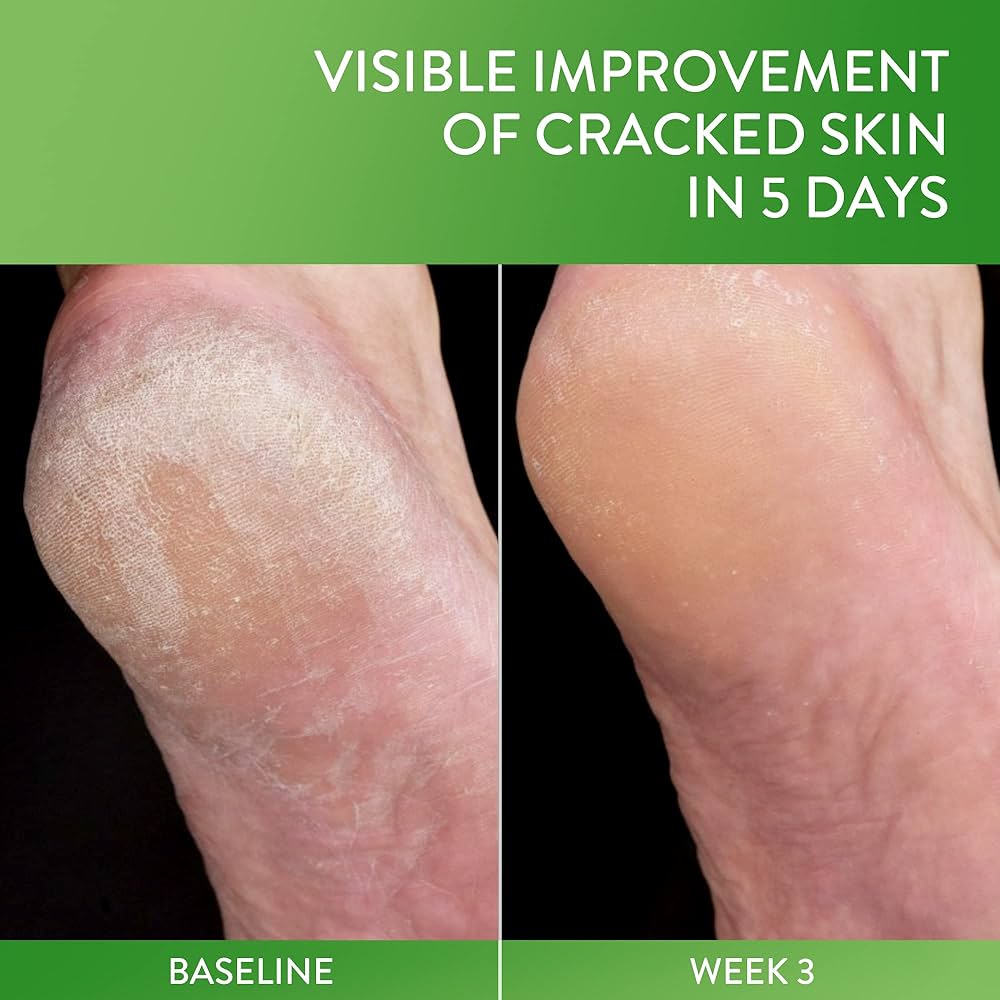 フットケア SkinVenus Premium repair Cream 22g 21VfWaVsRZL._UF350,350_QL50_.jpg