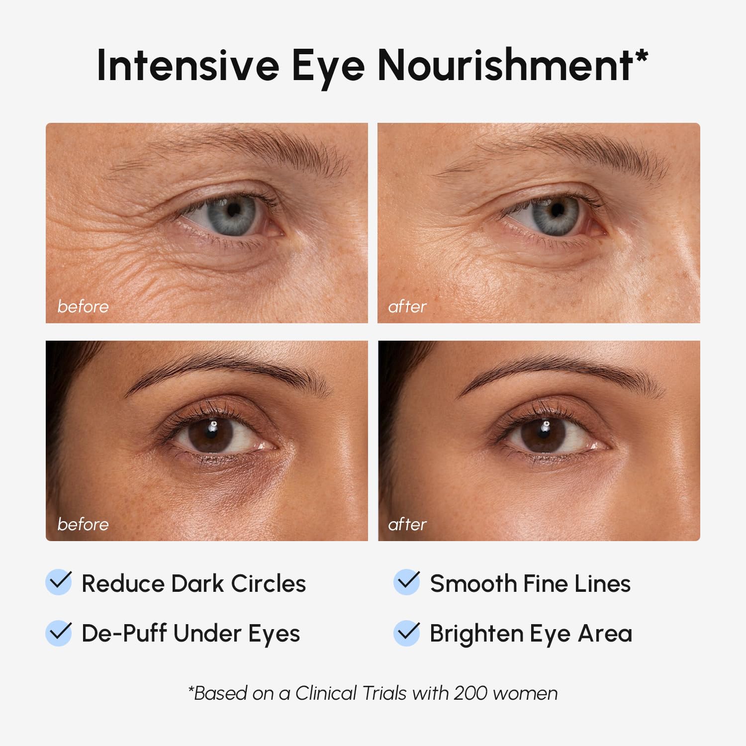 MAREE Parches invisibles debajo de los ojos para ojos hinchados y ojeras con colágeno péptido, cafeína y retinol, máscaras de ojos para mujeres y hombres para bolsas debajo de los ojos y reducción de