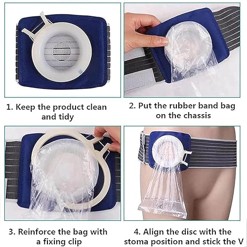 Miniatura 6 de Bolsa de colostomía unisex para estomía, cinturón de hernia de ostomía para cuidado postoperatorio de anorrectal, para prevenir hernia parastomal,