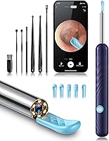 Kolrry Ear Wax Removal Kit with 1080P Camera & Light, 6 Soft Spoons, FSA HSA Eligible Ear Cleaner Tool