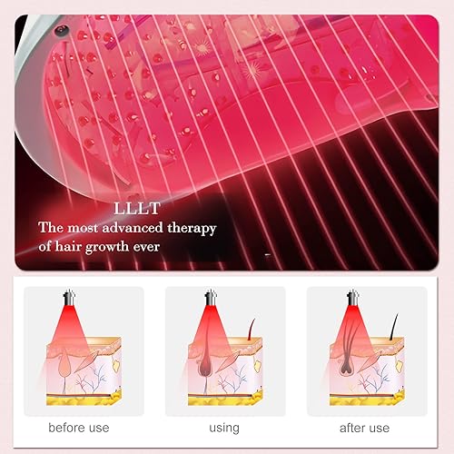 Vista 5 de Laser Hair Growth System, Hair Regrowth Helmet & Laser Cap (FDA Cleared), Hair Loss Treatment for Men and Women, Low Level Laser Therapy for Hair