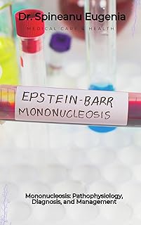 Mononucleosis: Pathophysiology, Diagnosis, and Management