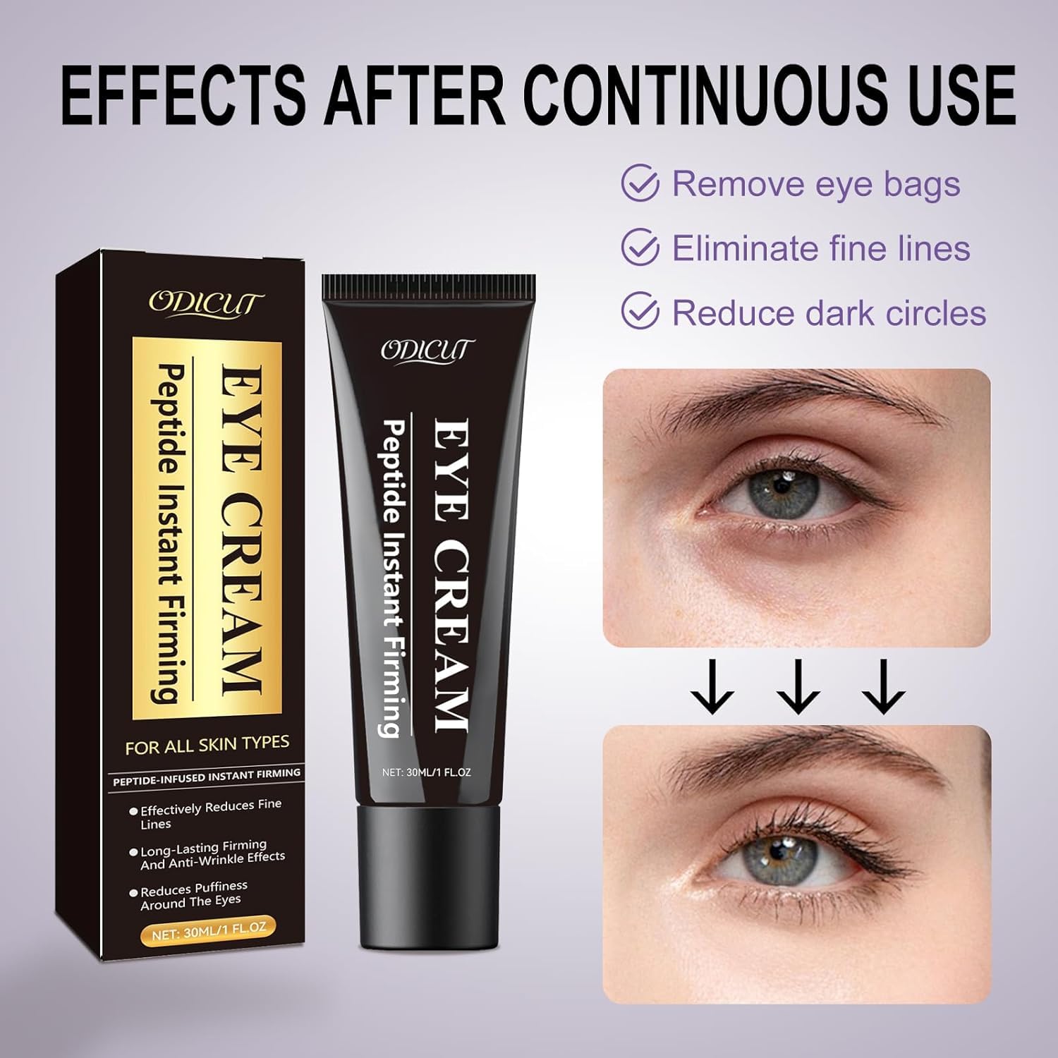Temporary Instant Eye Tightener Cream – 30 ML Under Eye Cream for Men & Women, Helps Improve the Appearance of Dark Circles, Puffiness & Fine Lines, Anti-Aging & Firming, Mild Hydrating Formula,1PACK - Image 7