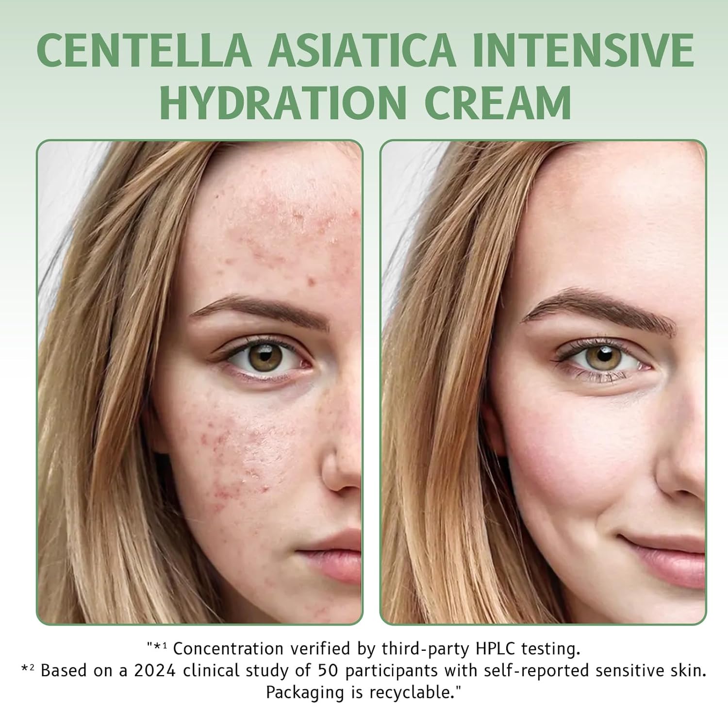 Centella Asiatica Intensive Hydration Cream, 85% Natural Ingredients, Long-Lasting Moisturizer for Sensitive Skin, 50g - Image 9