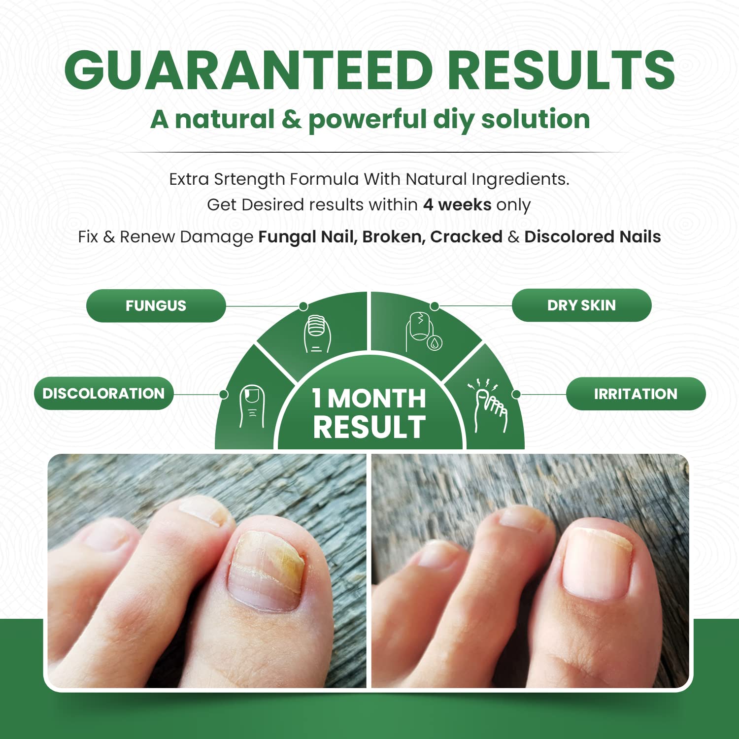 Foot Cure Extra Strong Nail & Toe Fungus Treatment - Made In USA, Best Nail Repair Set, Fungi Fingernail & Toenail Solution, Fix & Renew Damage Fungal Nail, Broken, Cracked & Discolored Nails 1 Pack : Health & Household