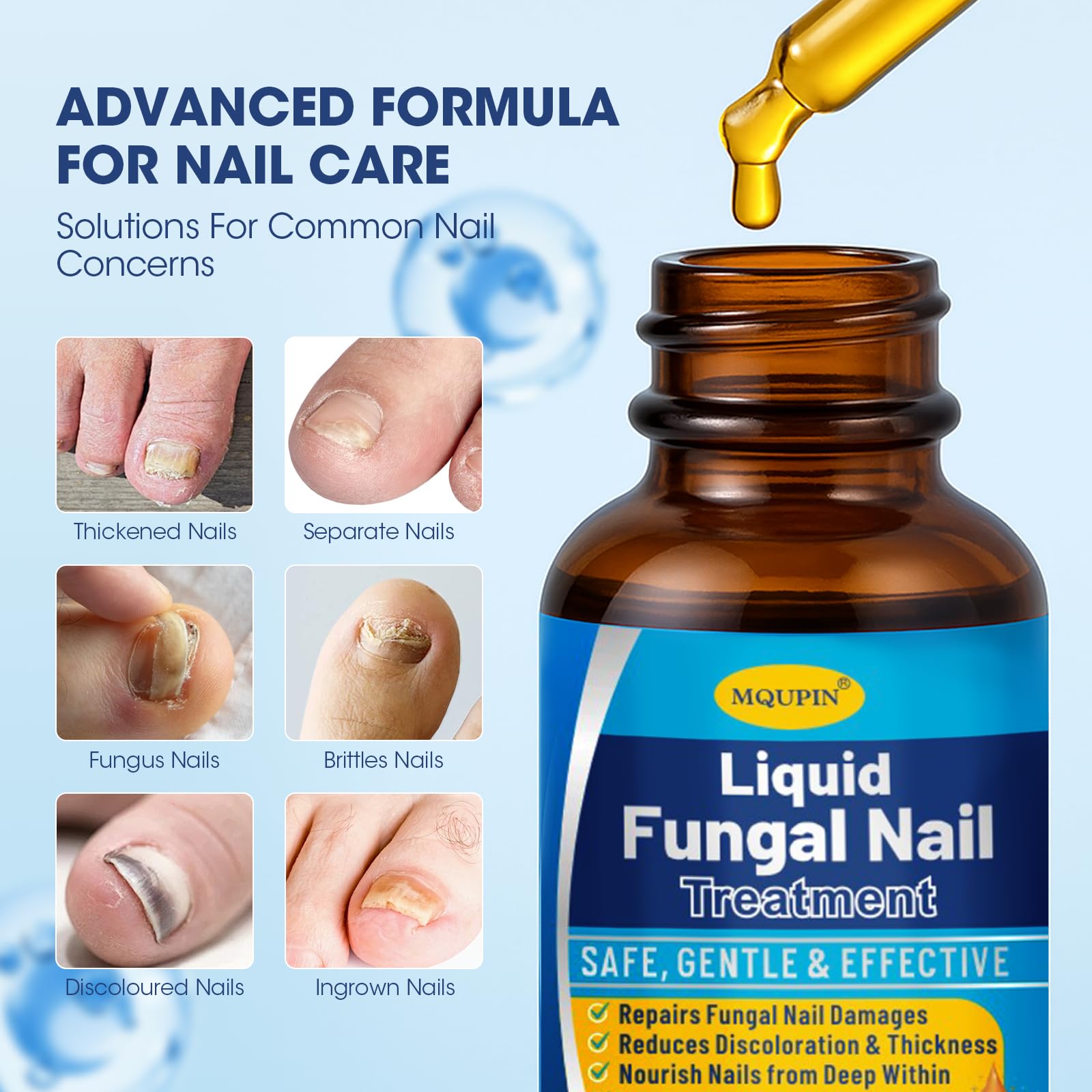 Fungal Nail Treatment For Toenails Extra Strong,MQUPIN Nail Fungus Treatment For Toenail & Finger - Image 3