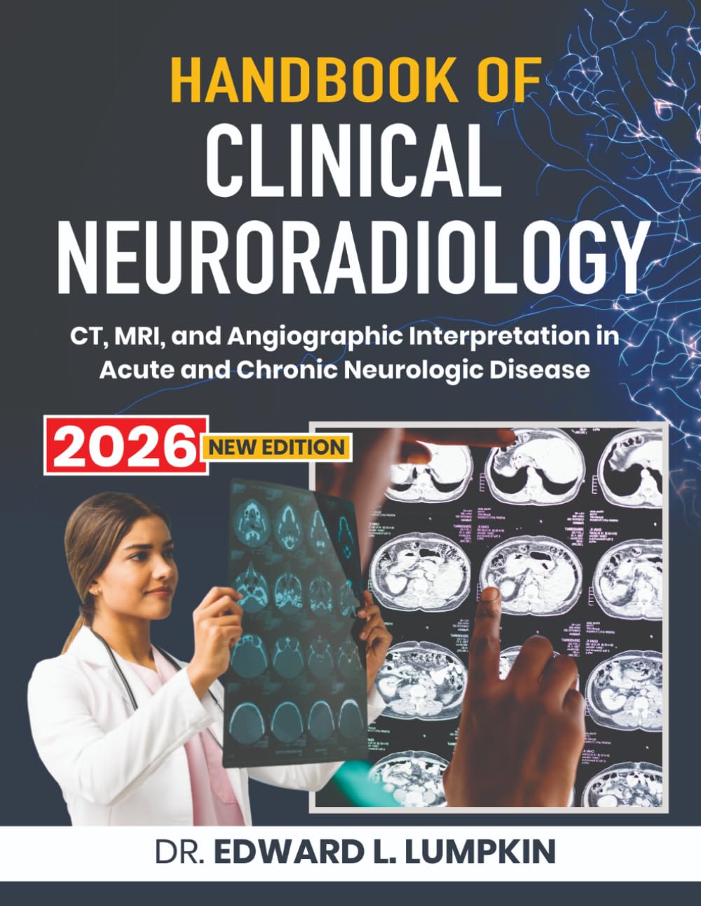 Handbook of Clinical Neuroradiology: CT, MRI, and Angiographic Interpretation in Acute and Chronic Neurologic Disease
