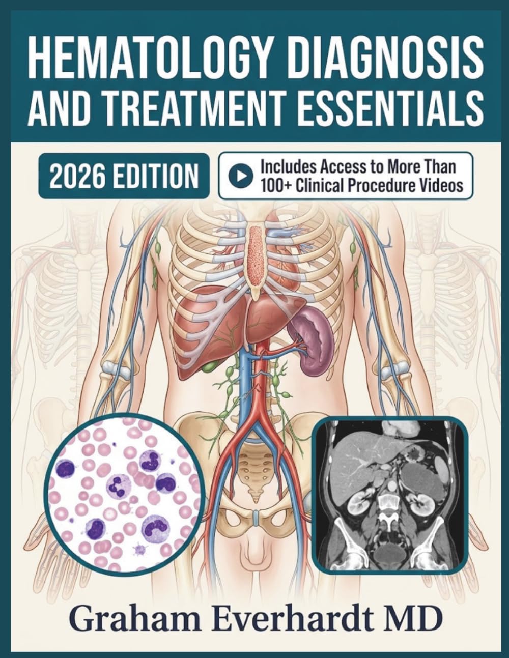 HEMATOLOGY DIAGNOSIS AND TREATMENT ESSENTIALS: A Clinical Guide to Anemias, Bleeding Disorders, and Blood Cancers with Management Workflows