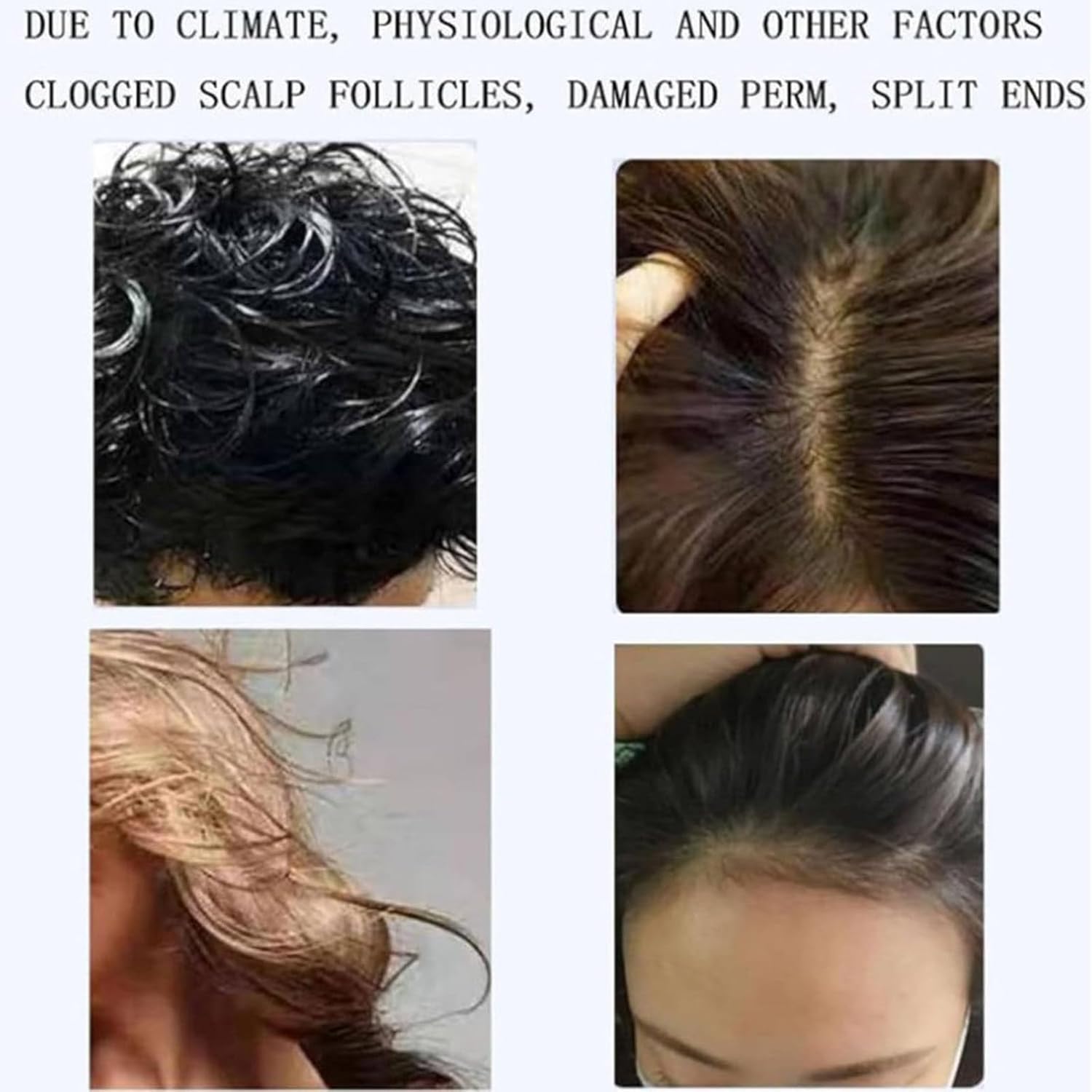 Analizzatore per Capelli diagnostico della Pelle, Scanner per la Pelle del Viso con Display LCD Multifunzionale per Capelli e Pelle con 7 Maniglie per Salone di Bellezza Domestico