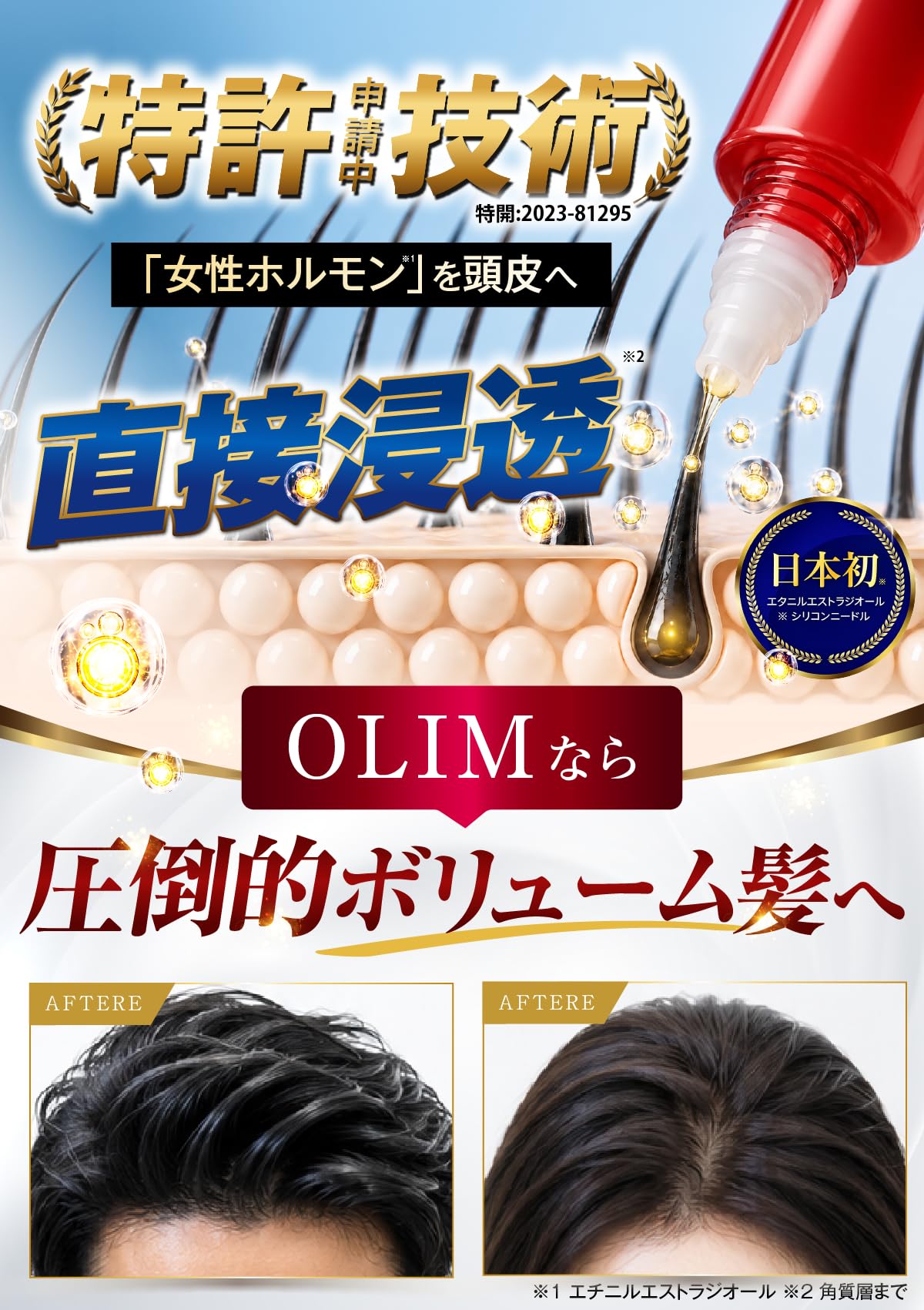 Amazon | 【頭皮に直接届けるニードルヘッド採用】OLIM オーリム 育毛 