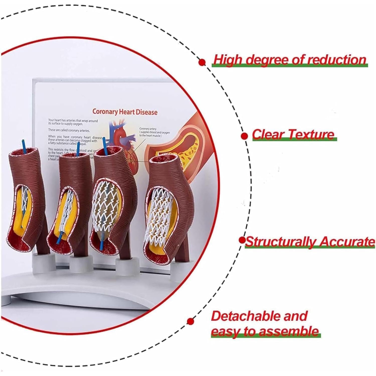 model anatomiczny, Model nauczania okluzji naczyń krwionośnych
