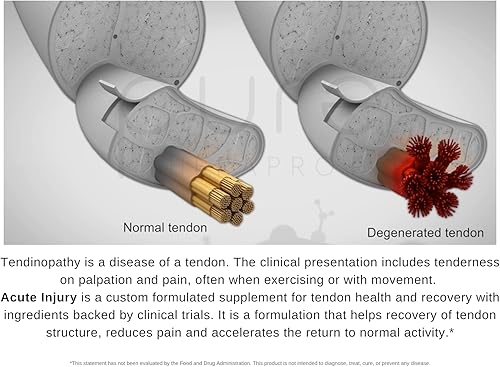 Miniatura 8 de Pure Therapro Rx Paquete de articulaciones y tendones saludables