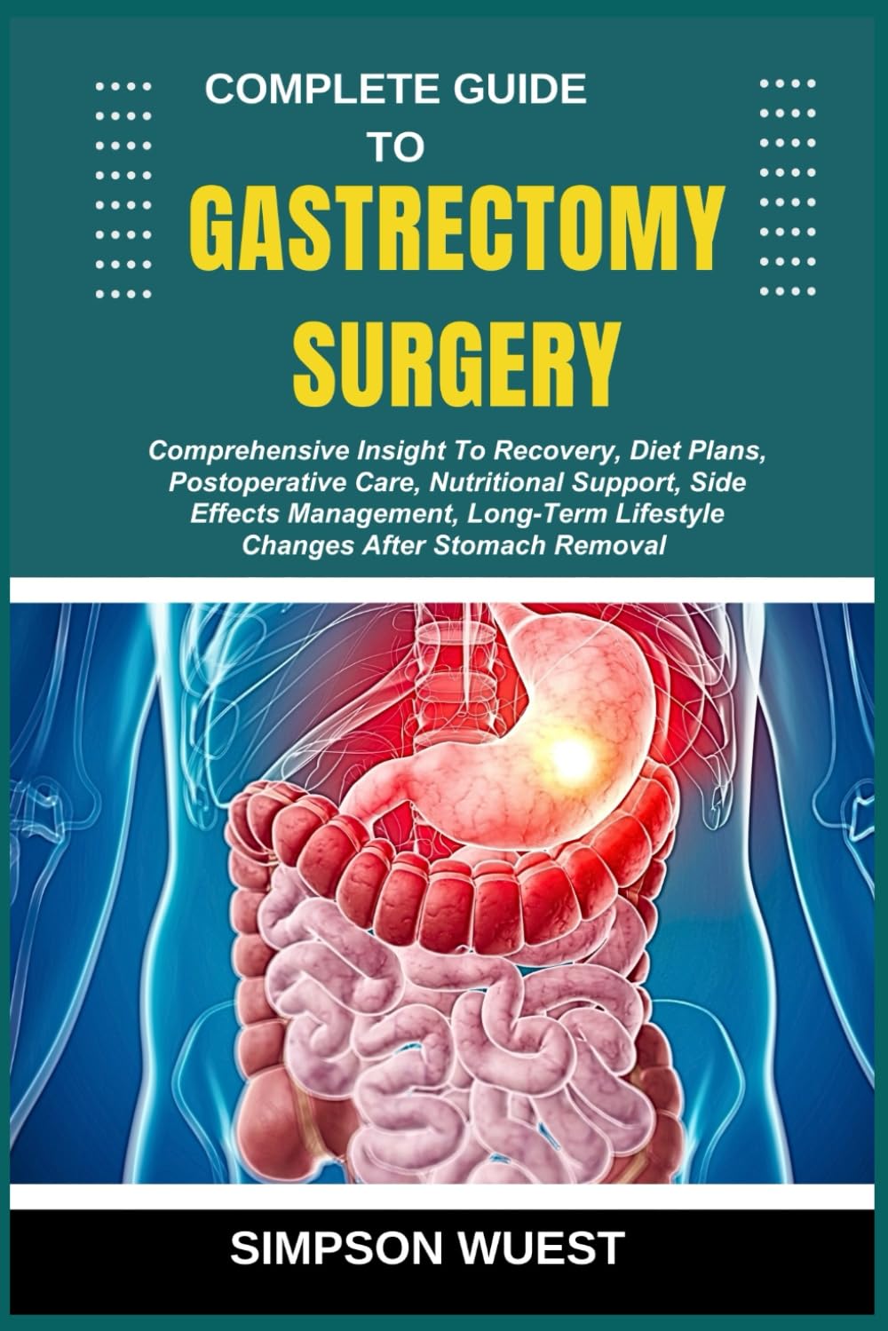 COMPLETE GUIDE TO GASTRECTOMY SURGERY: Comprehensive Insight To Recovery, Diet Plans, Postoperative Care, Nutritional Support, Side Effects ...