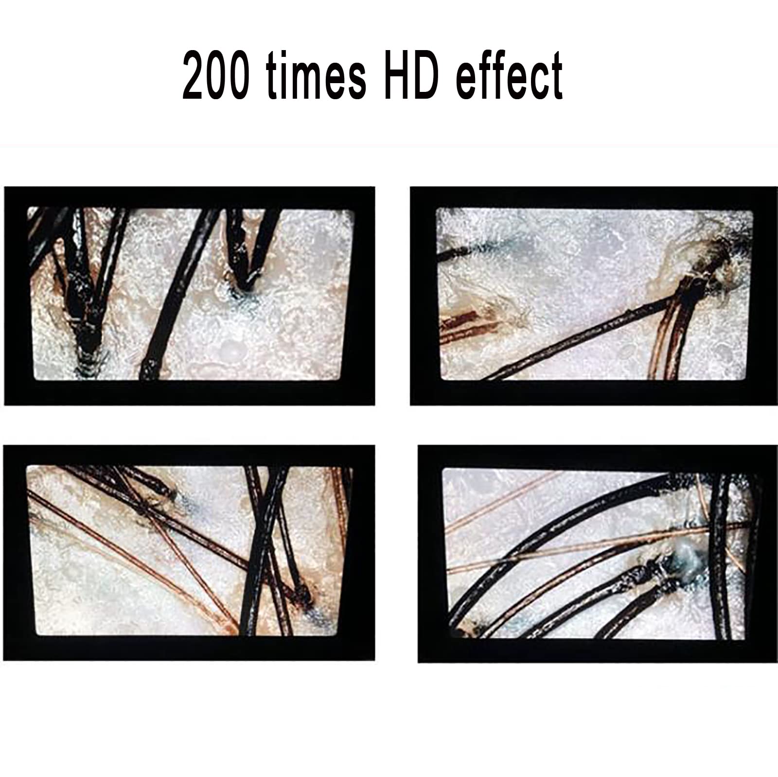 Analizzatore di capelli per diagnosi della pelle, scanner digitale per diagnosi della pelle con schermo LCD da 5 pollici, macchina per analizzatori di capelli ricaricabile 50X 200X, per casa, salone