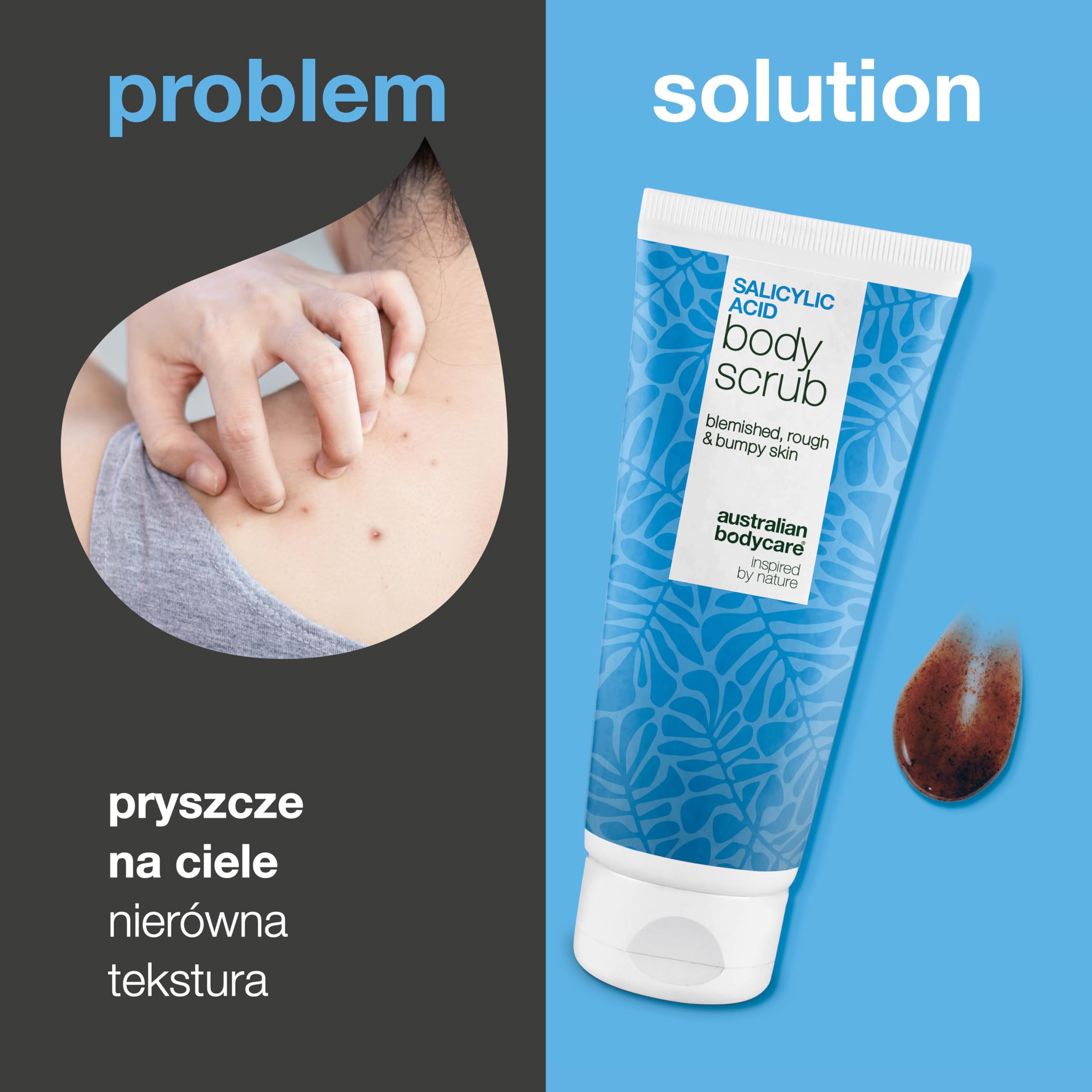 Peeling do ciała z kwasem salicylowym na trądzik, zaskórniki i niedoskonałości na plecach, pośladkach i ciele – usuwa martwy naskórek dzięki kwasom salicylowym (BHA) i glikolowym (AHA) oraz gliceryną