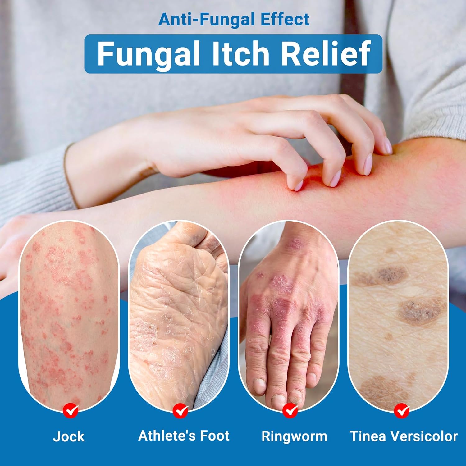 ishancare Anti Itch Cream Extra Strength, Oatmeal Soothing Skin Itch Relief Ointment for Rash, Dermatitis, Eczema, Psoriasis, Hives, Sun, Bites, Poison Ivy, Large Can 3.5 oz - Image 4