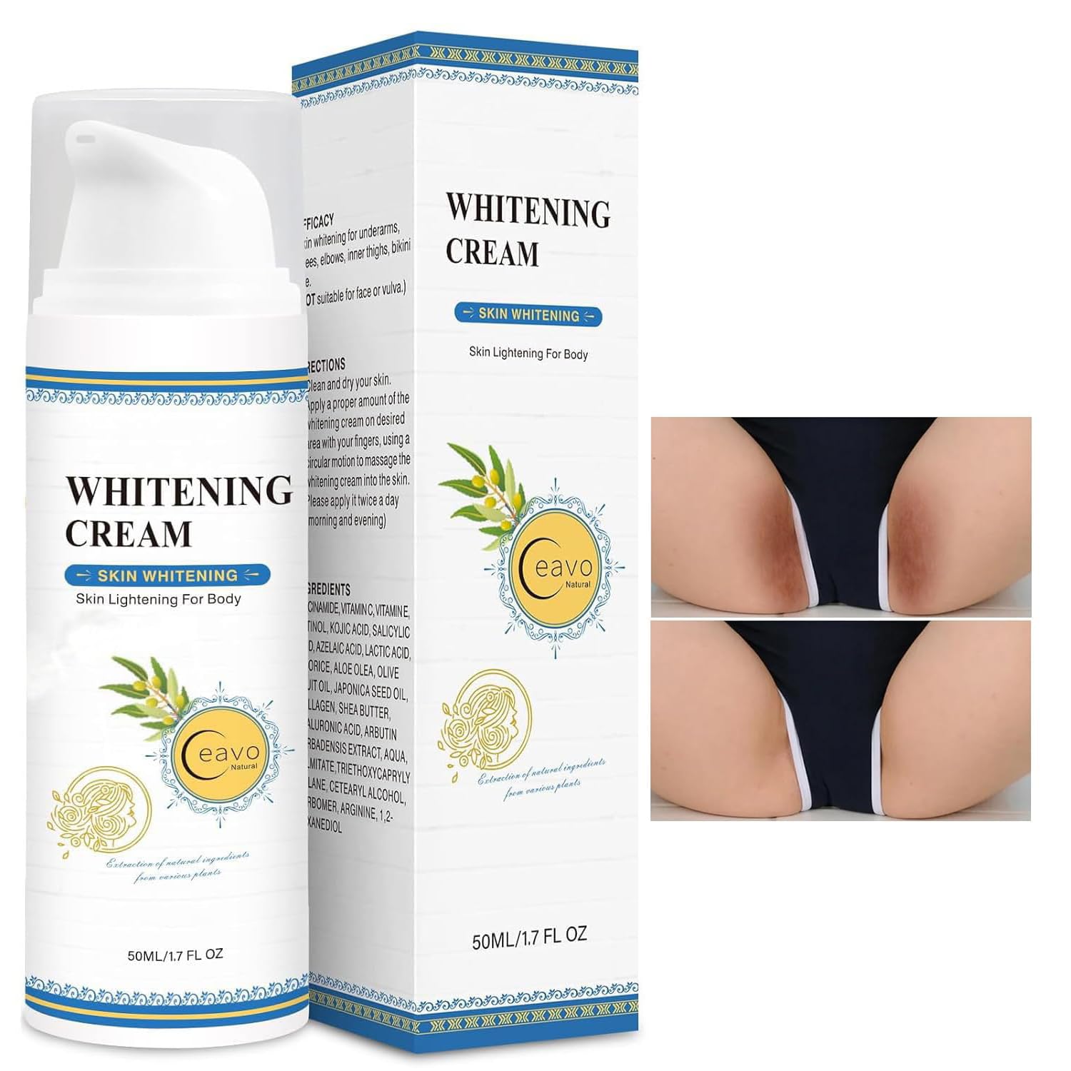 Skin Whitening Cream Bleaching Cream for Body Intimate Area, Private Parts, Underarm, Knees, Elbows, Inner Thigh, Bikini Areas, Bikini Line, Lightening Dark Spot Remover For Intimate Part (1.7FL OZ)
